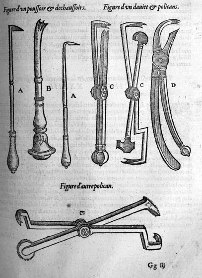 Instruments gravés dans les Œuvres d’Ambroise Paré, 1585 : poussoirs, déchaussoirs, davier et pélican, pour les dents. Le matériel d’un métier contemporain de Germain Cheval, sans attribution à sa personne.